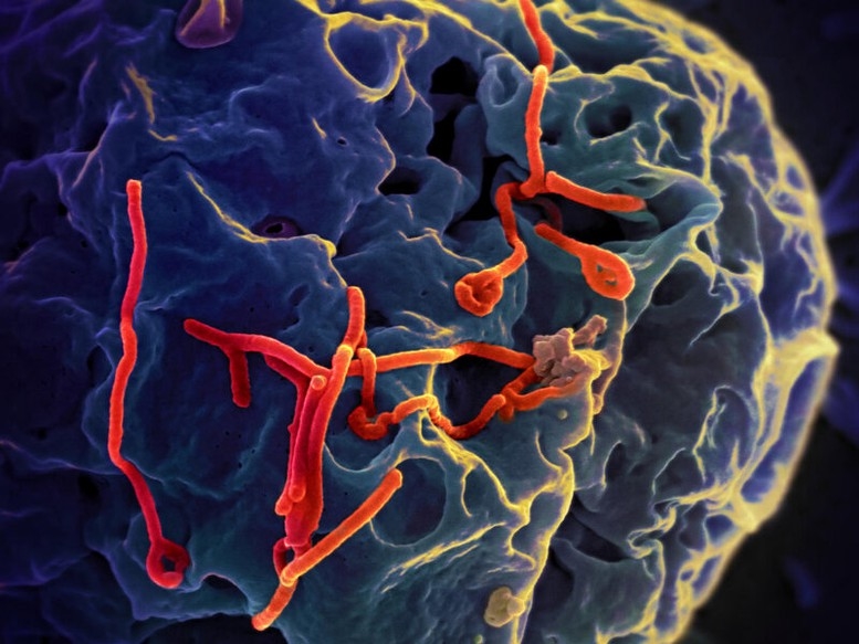 Thông tin, khuyến cáo phòng, chống bệnh do vi rút Ebola